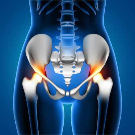 3D render of a medical female showing pain in hip joints